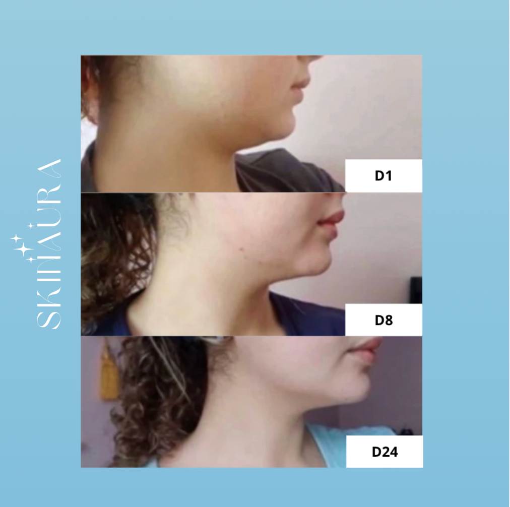 The Shaper™- Fit Face Mask